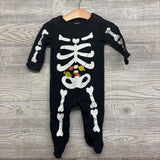 Skeleton Outfit W/ Candy 9M