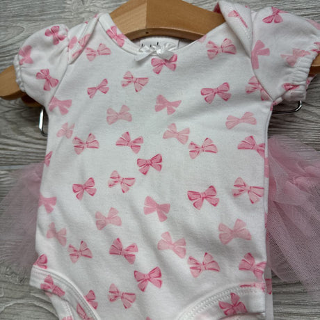 Bodysuit Bows & Skeggings 0-3M